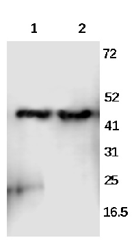 DLX5 Rabbit Polyclonal Antibody
