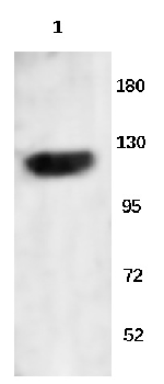 EPHA3 Rabbit Polyclonal Antibody