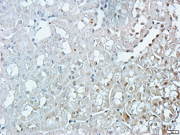 mTOR Rabbit Polyclonal Antibody