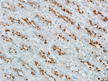 mTOR Rabbit Polyclonal Antibody