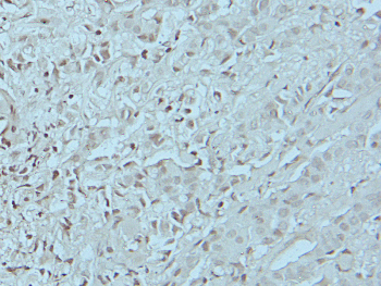 FYN (Phospho-Y530) Rabbit Polyclonal Antibody