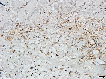 GATA1 Rabbit Polyclonal Antibody