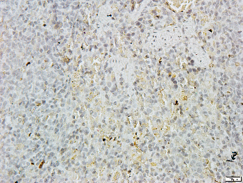 GATA1 Rabbit Polyclonal Antibody