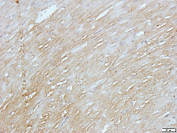 RRAD Rabbit Polyclonal Antibody