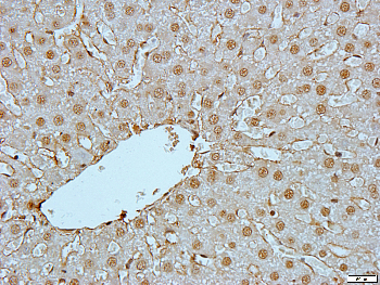 RRAD Rabbit Polyclonal Antibody