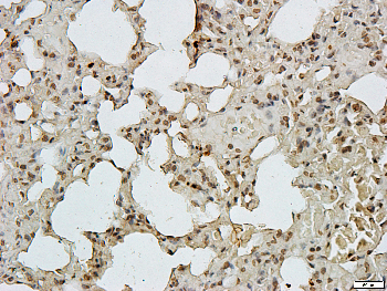 RRAD Rabbit Polyclonal Antibody