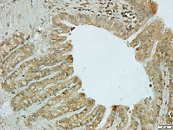 RRAD Rabbit Polyclonal Antibody