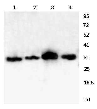 RRAD Rabbit Polyclonal Antibody