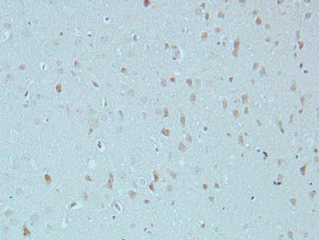 SOX9 (Phospho-S181) Rabbit Polyclonal Antibody