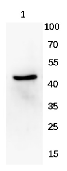 Beta-actin Rabbit Polyclonal Antibody