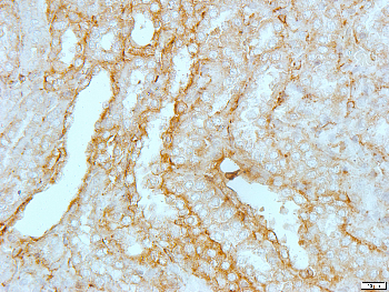 Beta-actin Rabbit Polyclonal Antibody