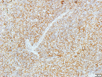 Beta-actin Rabbit Polyclonal Antibody