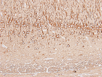 TUBB3 Mouse Monoclonal Antibody
