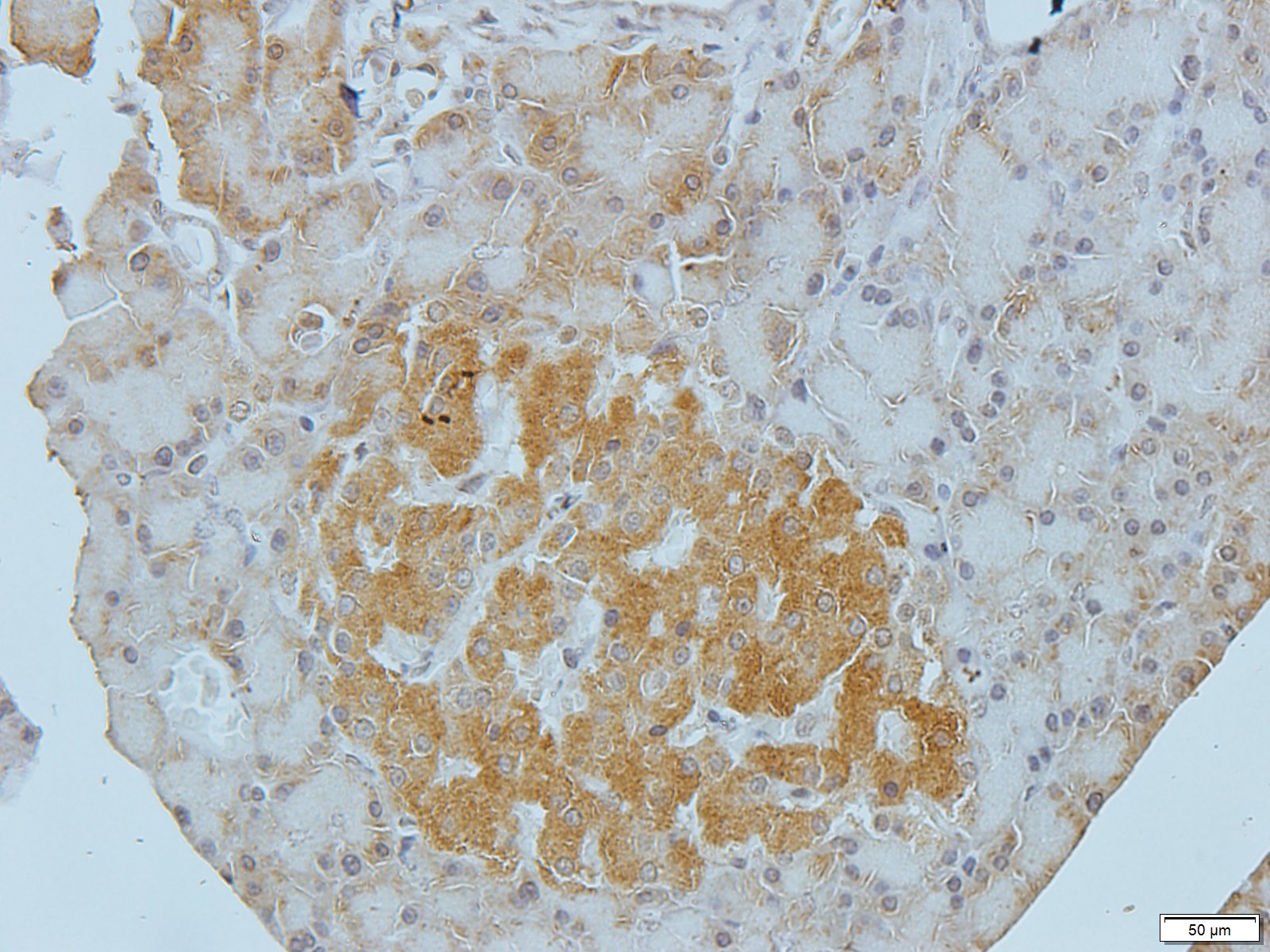 Filaggrin Rabbit Polyclonal Antibody