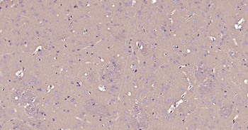 CD90/Thy-1 Rabbit Polyclonal Antibody