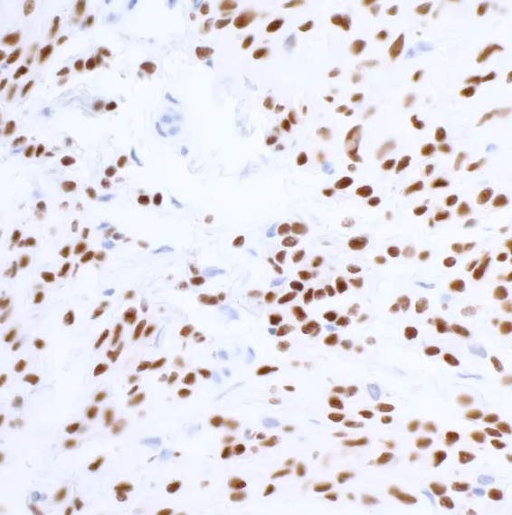 SOX10 Rabbit Recombinant Monoclonal Antibody
