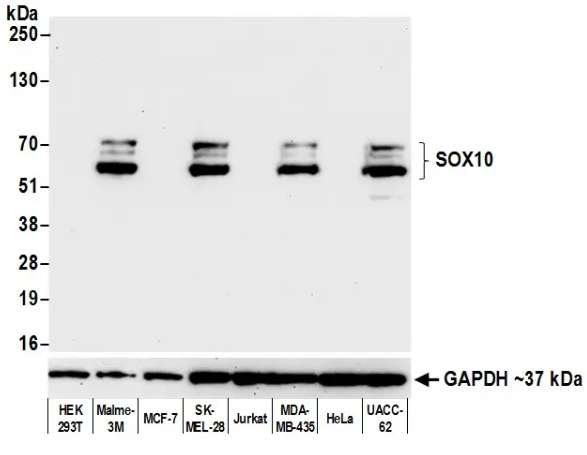 SOX10 Rabbit Recombinant Monoclonal Antibody