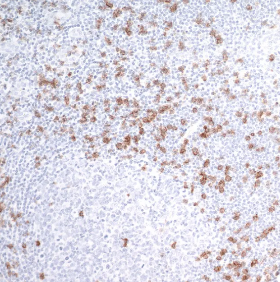 CD8 alpha Rabbit Recombinant Monoclonal Antibody