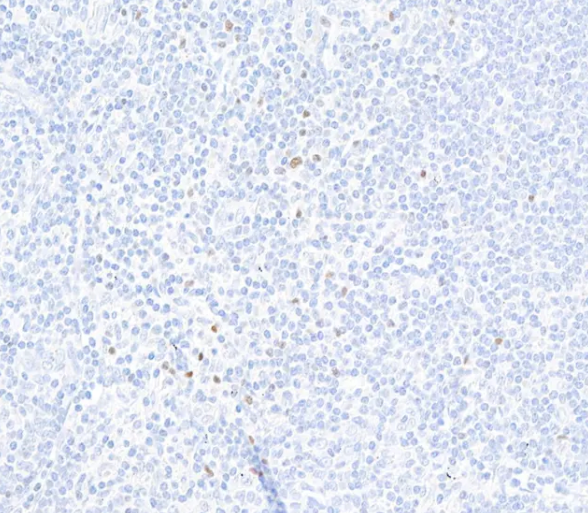 FOXP3 Rabbit Recombinant Monoclonal Antibody