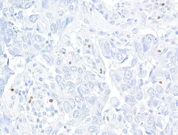 FOXP3 Rabbit Recombinant Monoclonal Antibody