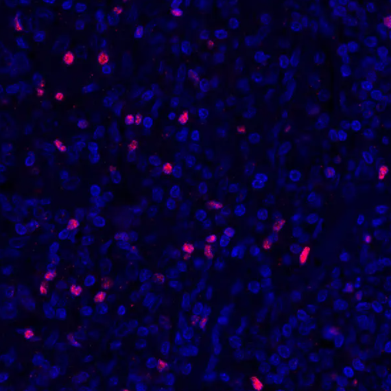 FOXP3 Rabbit Recombinant Monoclonal Antibody
