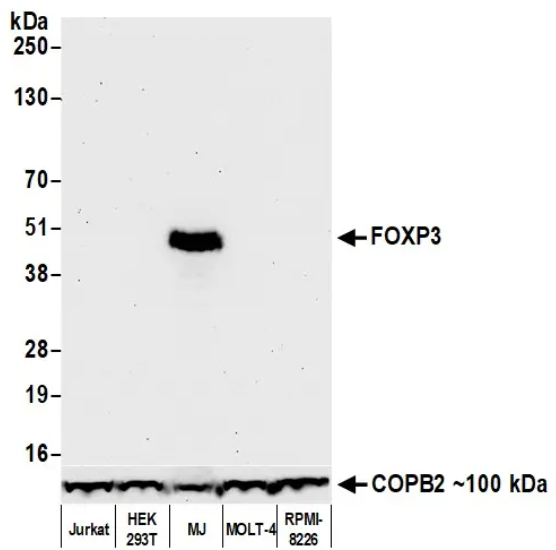 FOXP3 Rabbit Recombinant Monoclonal Antibody