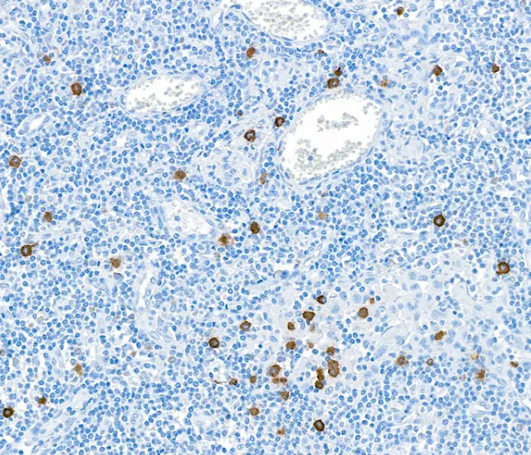 Granzyme B Rabbit Recombinant Monoclonal Antibody