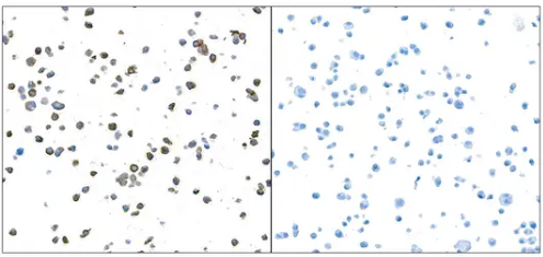 Granzyme B Rabbit Recombinant Monoclonal Antibody