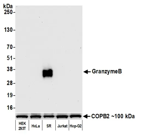 Granzyme B Rabbit Recombinant Monoclonal Antibody