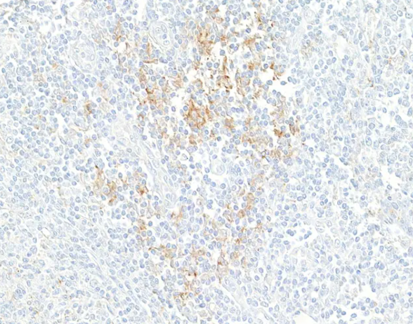 PD-L1 Rabbit Recombinant Monoclonal Antibody