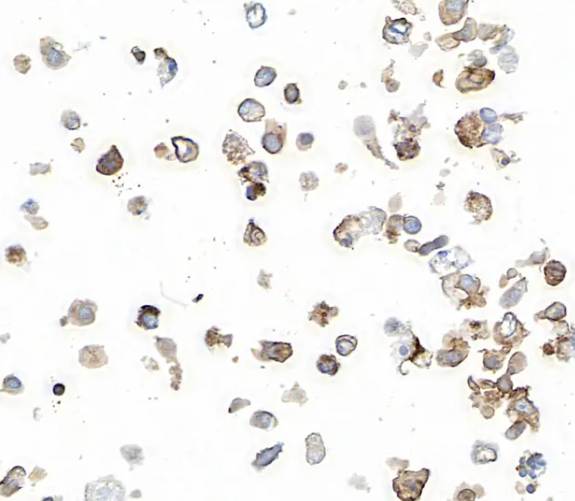 PD-L1 Rabbit Recombinant Monoclonal Antibody