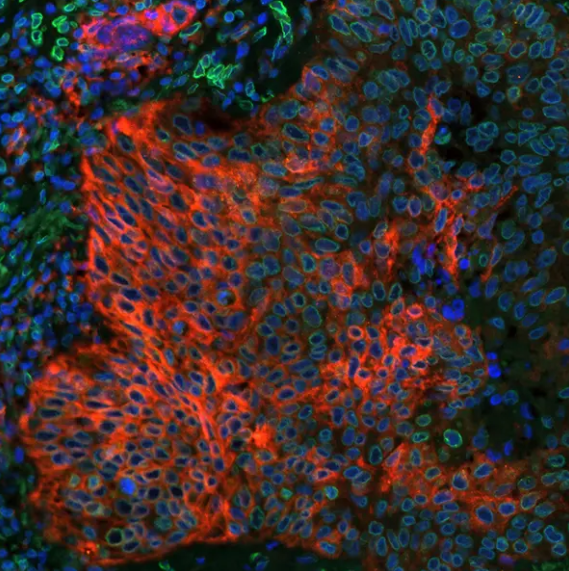 PD-L1 Rabbit Recombinant Monoclonal Antibody