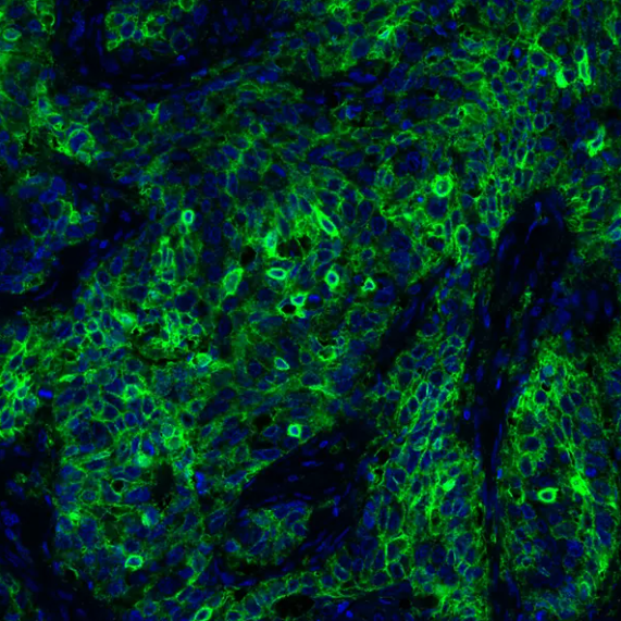 PD-L1 Rabbit Recombinant Monoclonal Antibody