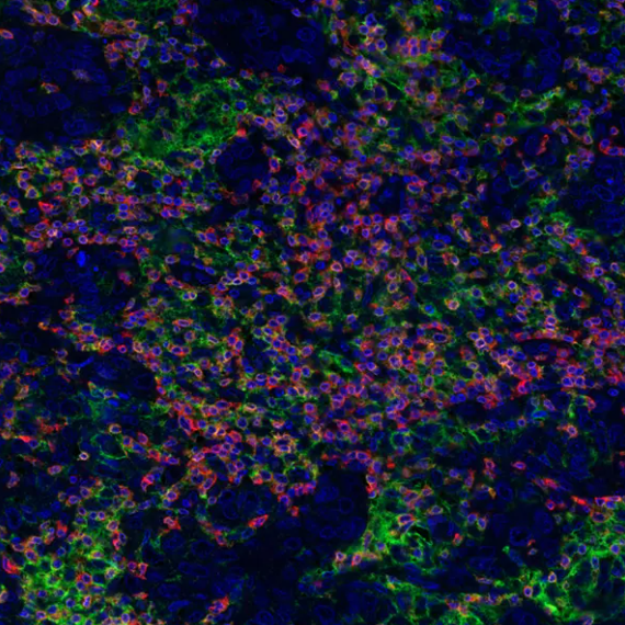 PD-L1 Rabbit Recombinant Monoclonal Antibody