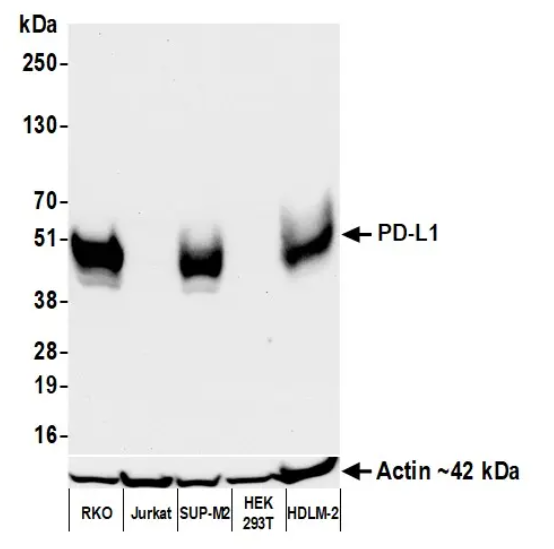 PD-L1 Rabbit Recombinant Monoclonal Antibody