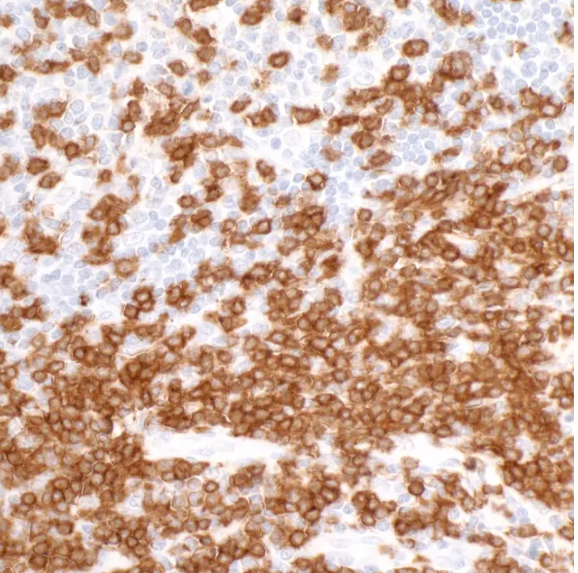 CD3E Rabbit Recombinant Monoclonal Antibody