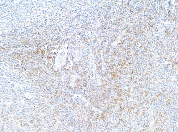 CD4 Rabbit Recombinant Monoclonal Antibody