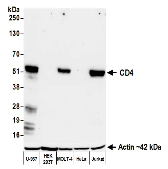 CD4 Rabbit Recombinant Monoclonal Antibody