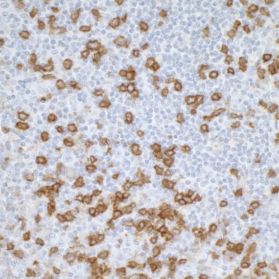 CD45RO Mouse Monoclonal Antibody