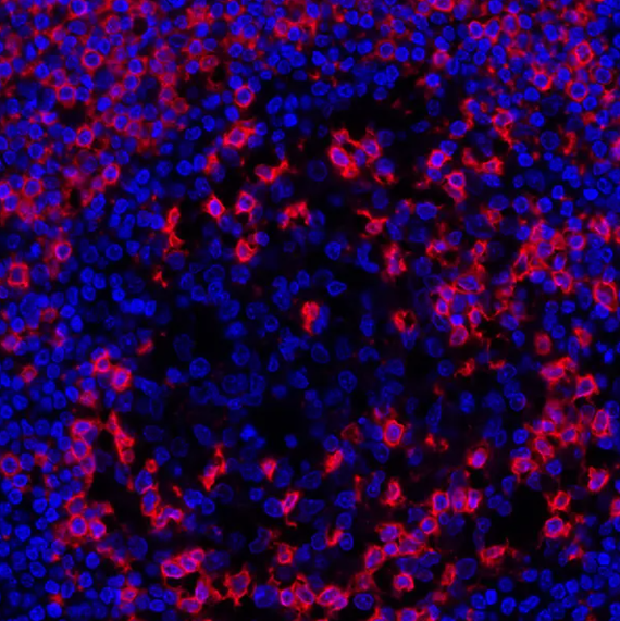 CD45RO Mouse Monoclonal Antibody