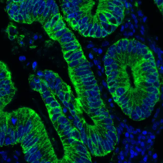Cytokeratin Mouse Monoclonal Antibody