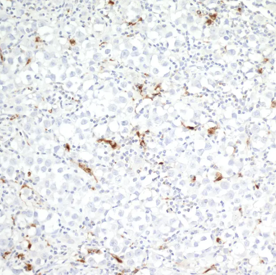 CD68 Mouse Recombinant Monoclonal Antibody