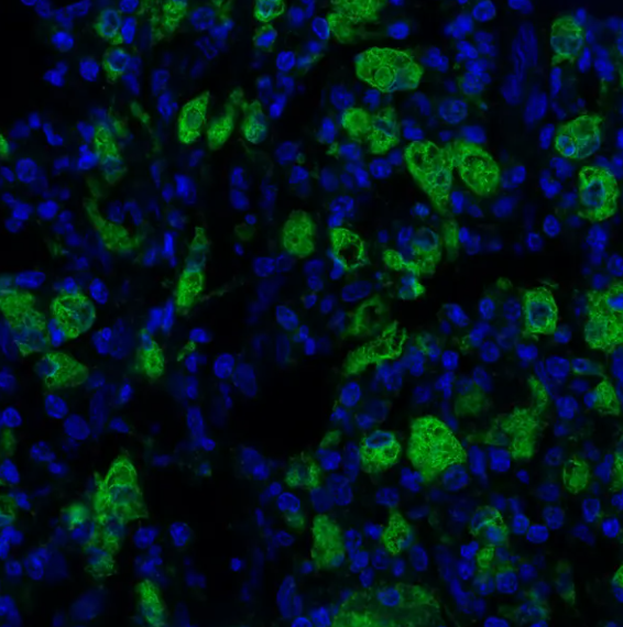 CD68 Mouse Recombinant Monoclonal Antibody