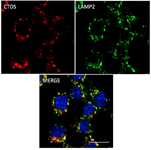 Cathepsin D Antibody