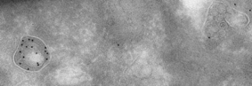 Cathepsin D Antibody