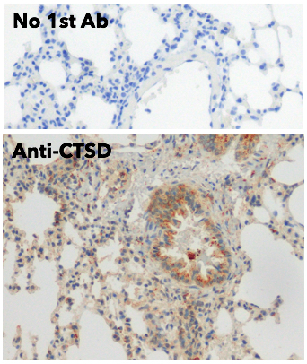 Cathepsin D Antibody