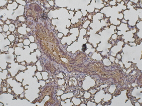 Cathepsin D Antibody