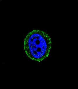 CALCR Antibody (C-term)