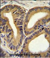 TRIM65 Antibody (Center)