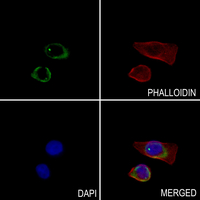 TRBC1 Rabbit Polyclonal Antibody
